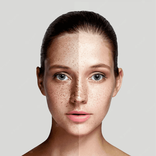 Pigmentation | EZ-Injections | Fountain Valley, CA